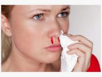 Nguyên nhân bị hắt xì ra máu mũi và cách phòng tránh